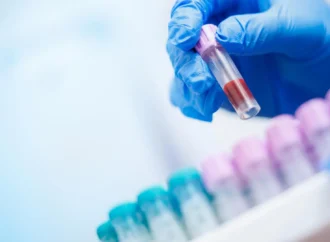 Descoberta de IA revela informações vitais em exames de sangue cotidianos