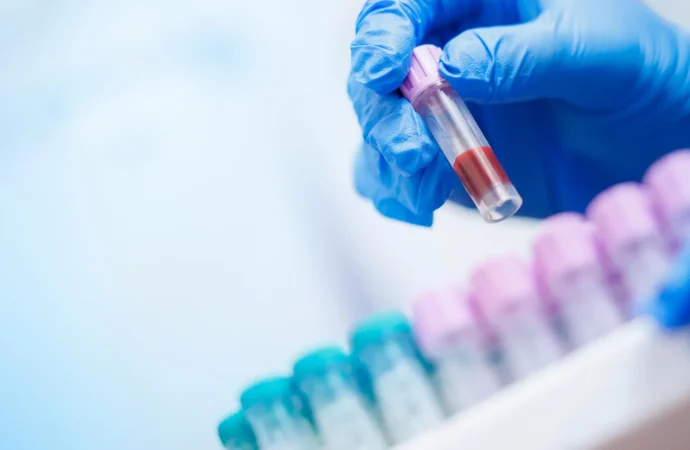 Descoberta de IA revela informações vitais em exames de sangue cotidianos