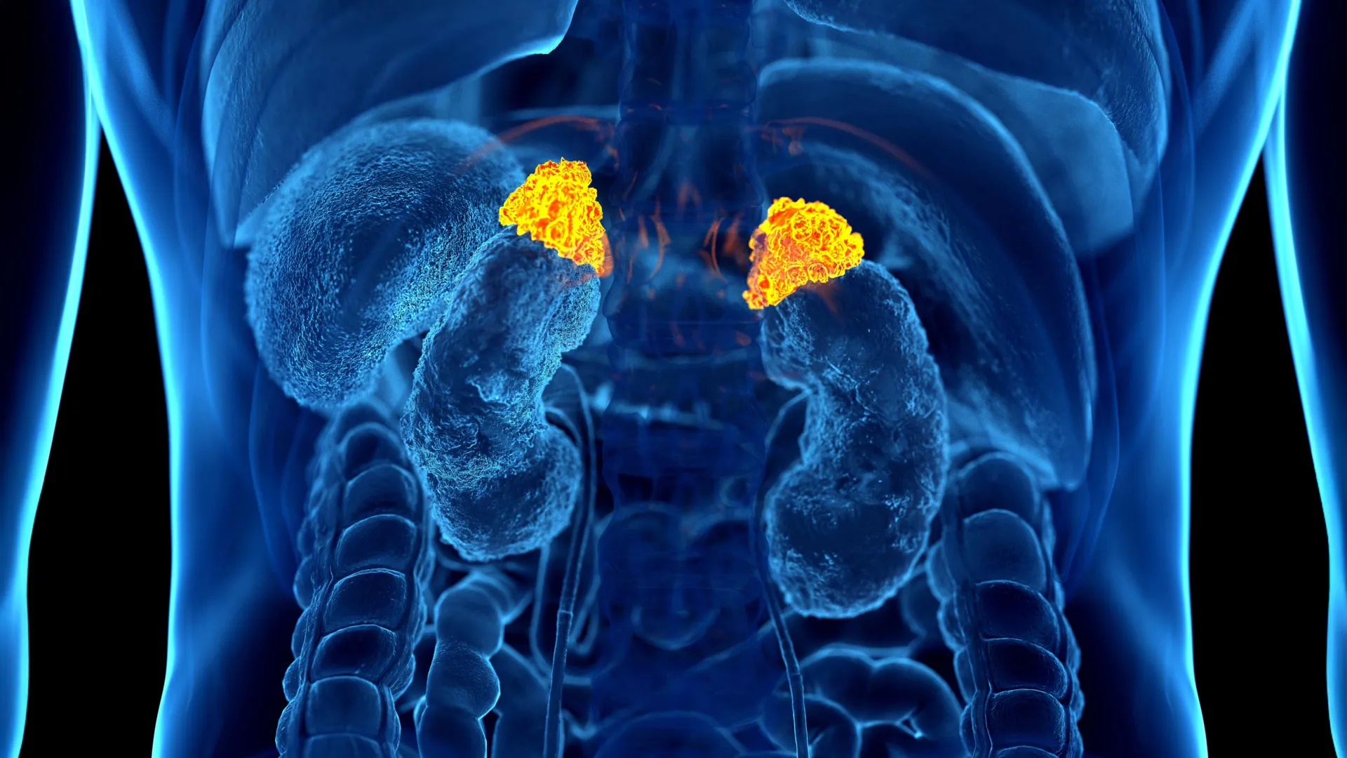 IA descobre um sinal de estresse oculto em exames de TC