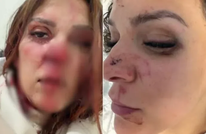 Mulher agredida pelo cônjuge no Porto. Suspeito fugiu para o Brasil – PPulse